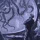 Illustration for article titled Sexual Swordplay, 80s Montages and Murder Dominate McGs 20,000 Leagues